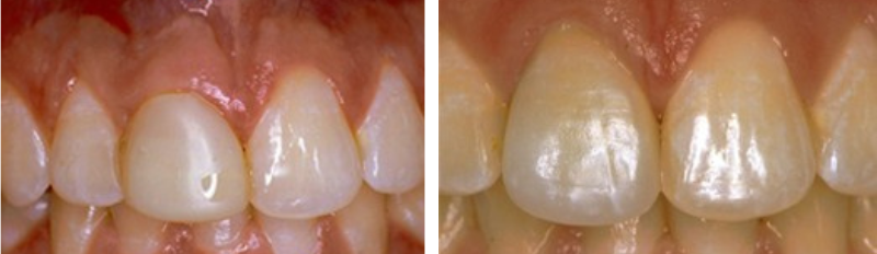 before after images before after images