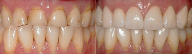 before after images before after images