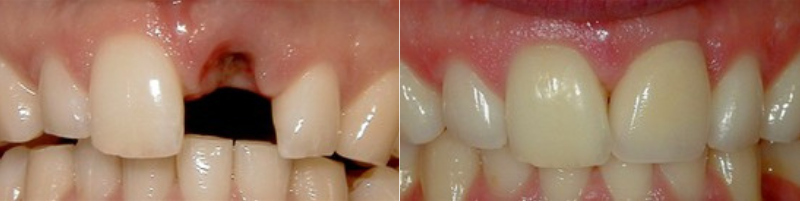 before after images before after images