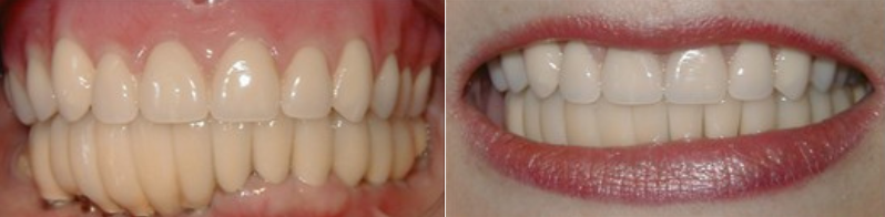 before after images before after images